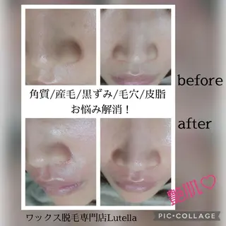 Lutella所属・ワックス脱毛専門店 Lutellaのエステ・リラクイメージ