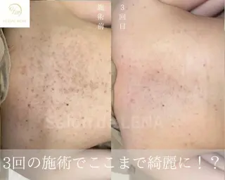 Grandir所属・ハーブピーリング専門 グランディール　武内のエステ・リラクイメージ