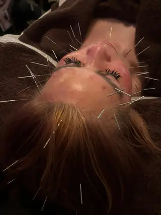 圧倒的たるみ改善 美容鍼エステのエステ・リラクイメージ