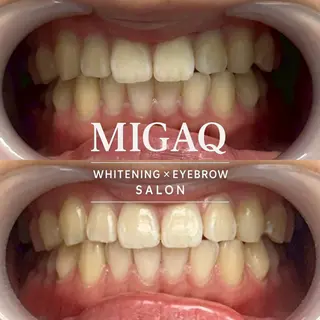 歯のホワイトニング専門店 MIGAQ 京都四条大宮店所属・佐藤 未来の眉毛・アイブロウイメージ