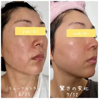 自然由来スキンケア/ 肌質改善/まつパのエステ・リラクイメージ