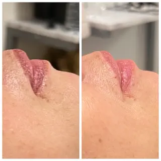 本気で痩せたい方へ 痩身専門サロンのエステ・リラクイメージ