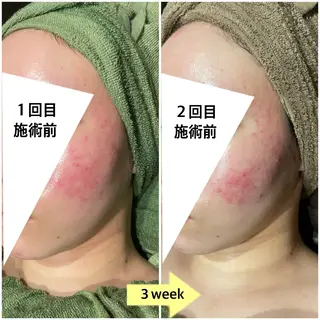 EARTH coiffure beaute 小山店所属・EARTH 小山店 shimaのエステ・リラクイメージ