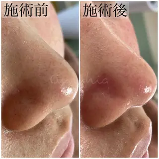 毛穴ケア専門店 Cynthiaのエステ・リラクイメージ