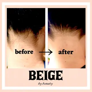 BEIGE 高崎駅近脱毛のエステ・リラクイメージ