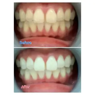 M渋谷店所属・M渋谷 ホワイトニングのエステ・リラクイメージ