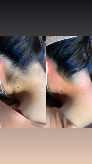 うなじラボ(UNAJI LABO)所属・池袋脱毛 さとうのエステ・リラクイメージ