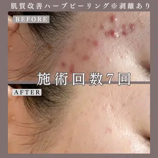 肌質改善専門サロン Bellmi/心斎橋のエステ・リラクイメージ