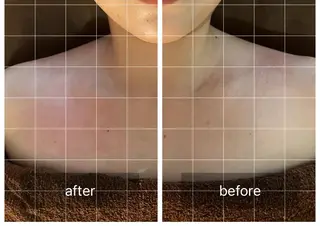 心斎橋痩身ダイエット 韓国.美容鍼.小顔のエステ・リラクイメージ
