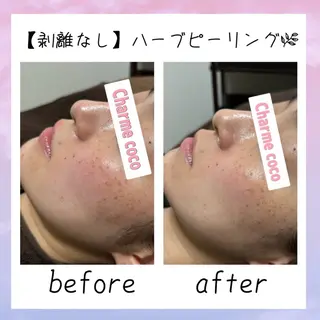 肌質改善Charme coco 増毛のエステ・リラクイメージ