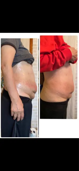 ミリ ミリのエステ・リラクイメージ