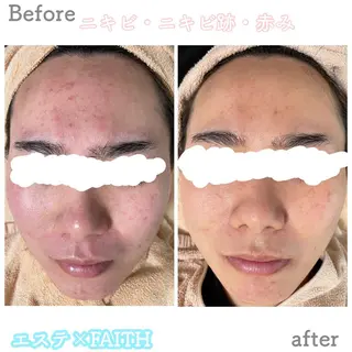 ミディアム カラー パーマ ヘアアレンジ メンズ キッズ ネイル マツエク・マツパ アイブロウ ニキビ&跡改善サロン オーナー光木のエステ・リラクイメージ