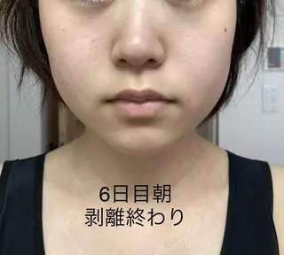 U24限定クーポン レイビス池袋MANAのエステ・リラクイメージ