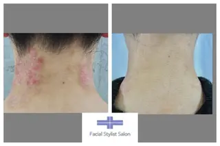 肌質改善専門サロン ／FSS渋谷店　松本のエステ・リラクイメージ