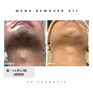 メンズ ウプエステティック所属・韓国肌管理 ウプエステティックのエステ・リラクイメージ