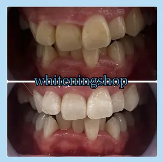 ホワイトニング ショップ千葉店のその他イメージ