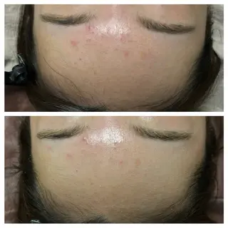 メンズ キッズ ホワイトニングサロン プレジールのエステ・リラクイメージ