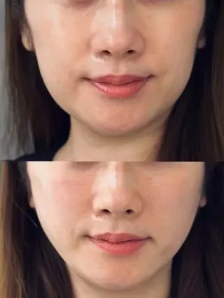 aliaハイフ&水光ジェットサロン所属・aliaハーブ水光店 エステティシャン募集のエステ・リラクイメージ