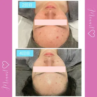 Monart -deux-のエステ・リラクイメージ