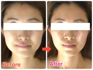 ショート カラー パーマ ヘアアレンジ メンズ キッズ ネイル マツエク・マツパ ‍痩身＆ボディ 結果出し🌟丹野のエステ・リラクイメージ