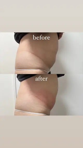 Miiju.所属・Miiju. 石巻市 脂肪冷却  鈴木のエステ・リラクイメージ