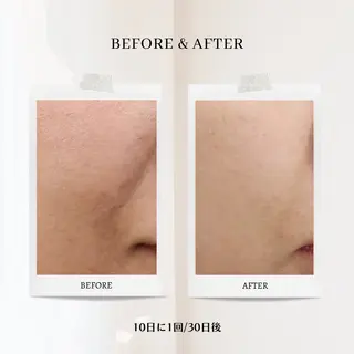 CHILO 銀座店のエステ・リラクイメージ