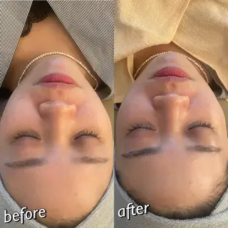 うなじ脱毛/美肌脱毛 LABELのエステ・リラクイメージ