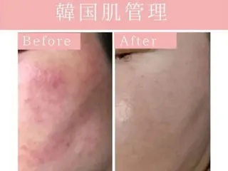 REMENTE池袋東口店所属・REMENTE🪞 KANAのエステ・リラクイメージ