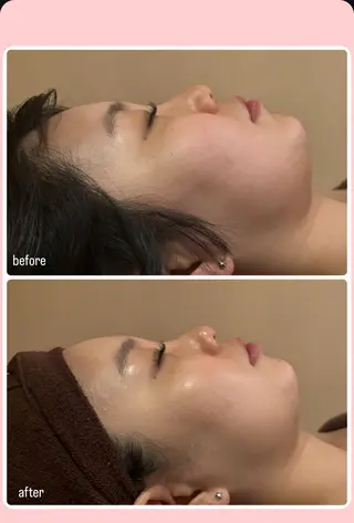 🎀葛野 日向子🎀のエステ・リラクイメージ