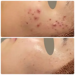 Lutan Richeさいたま店所属・ルタンリッシュ さいたま店のエステ・リラクイメージ