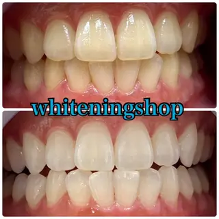 ホワイトニング ショップ吉祥寺店のエステ・リラクイメージ