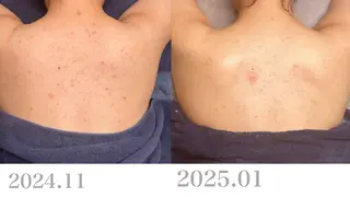 Le cherienのエステ・リラクイメージ