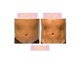 メンズ 癒し腸もみサロン シャユーム　ゆきなのエステ・リラクイメージ