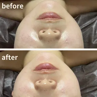 ReN所属・ReN エステサロンのエステ・リラクイメージ