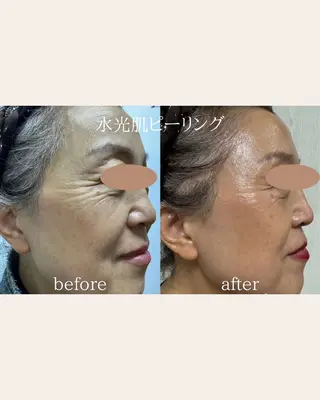 美腸サロン🌺 腸もみ/小顔/リンパのエステ・リラクイメージ