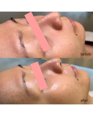 伊藤 稚菜のエステ・リラクイメージ