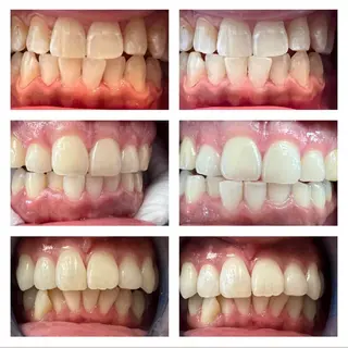 【肌質改善】 gluck豊田市美里のエステ・リラクイメージ