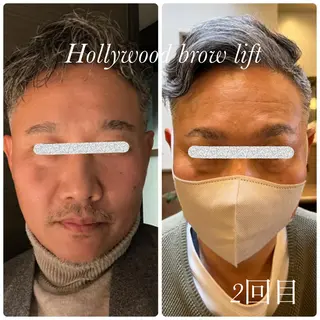 メンズ アイブロウ 《美肌&眉毛・美爪育成》深爪&長さ出し・フィルイン対応 RimisNailxbeauty 名駅所属・RimisNail /Jasmine ♡の眉毛・アイブロウイメージ