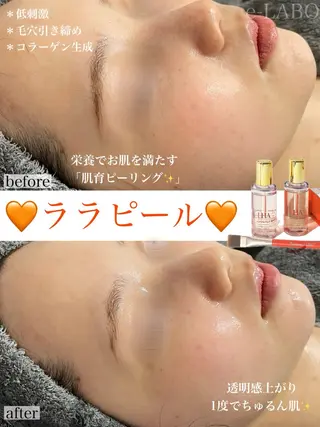 e-LABO こいずみのエステ・リラクイメージ