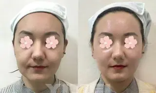 ショート aliaハイフ&水光ジェットサロン所属・aliaハーブ水光店 エステティシャン募集のエステ・リラクイメージ