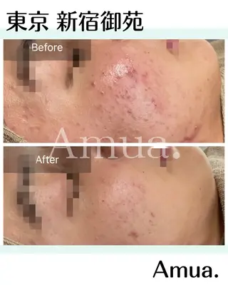 Amua.facial salon所属・Amua.ハーブ 新宿御苑駅前のエステ・リラクイメージ