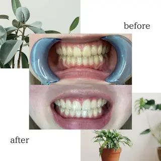 脱毛専門サロンELIXIR（ｴﾘｸｻｰ）所属・脱毛&ホワイトニング ELIXIR×ULTのエステ・リラクイメージ