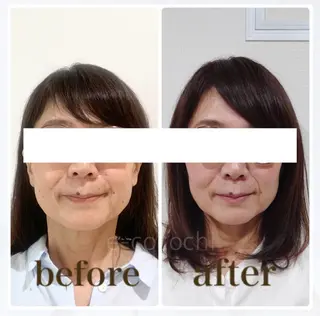 小顔と ヘッドスパのお店のエステ・リラクイメージ