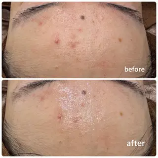 今西 彩夢のエステ・リラクイメージ