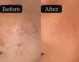 井上 裕子のエステ・リラクイメージ