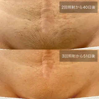 港区都度払い脱毛 miranjuのエステ・リラクイメージ