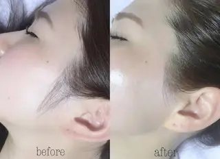 Nail & 高速脱毛 avenir【アヴニール】所属・WAX/眉/光脱毛 🌿リラク/小顔のエステ・リラクイメージ