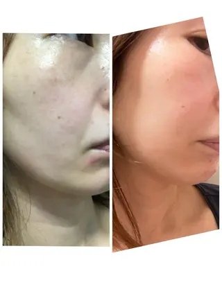 NARIS BEAUTY STATION　デ・アイム 長崎所属・立石 文香のエステ・リラクイメージ