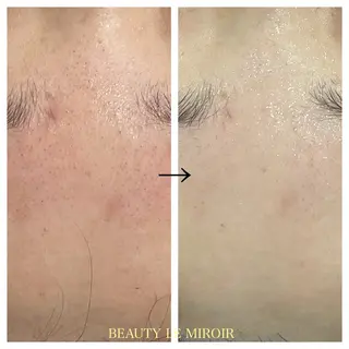 ビューティー ミロワールのエステ・リラクイメージ