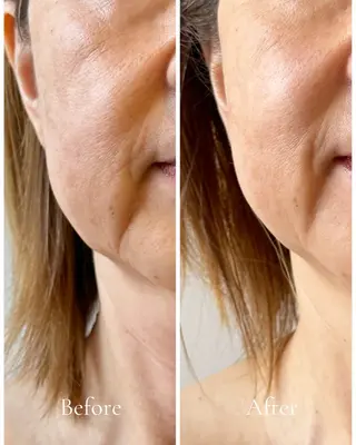 Lani Moon所属・⟡ 京都 小顔  ⊹ Lani Moonのエステ・リラクイメージ